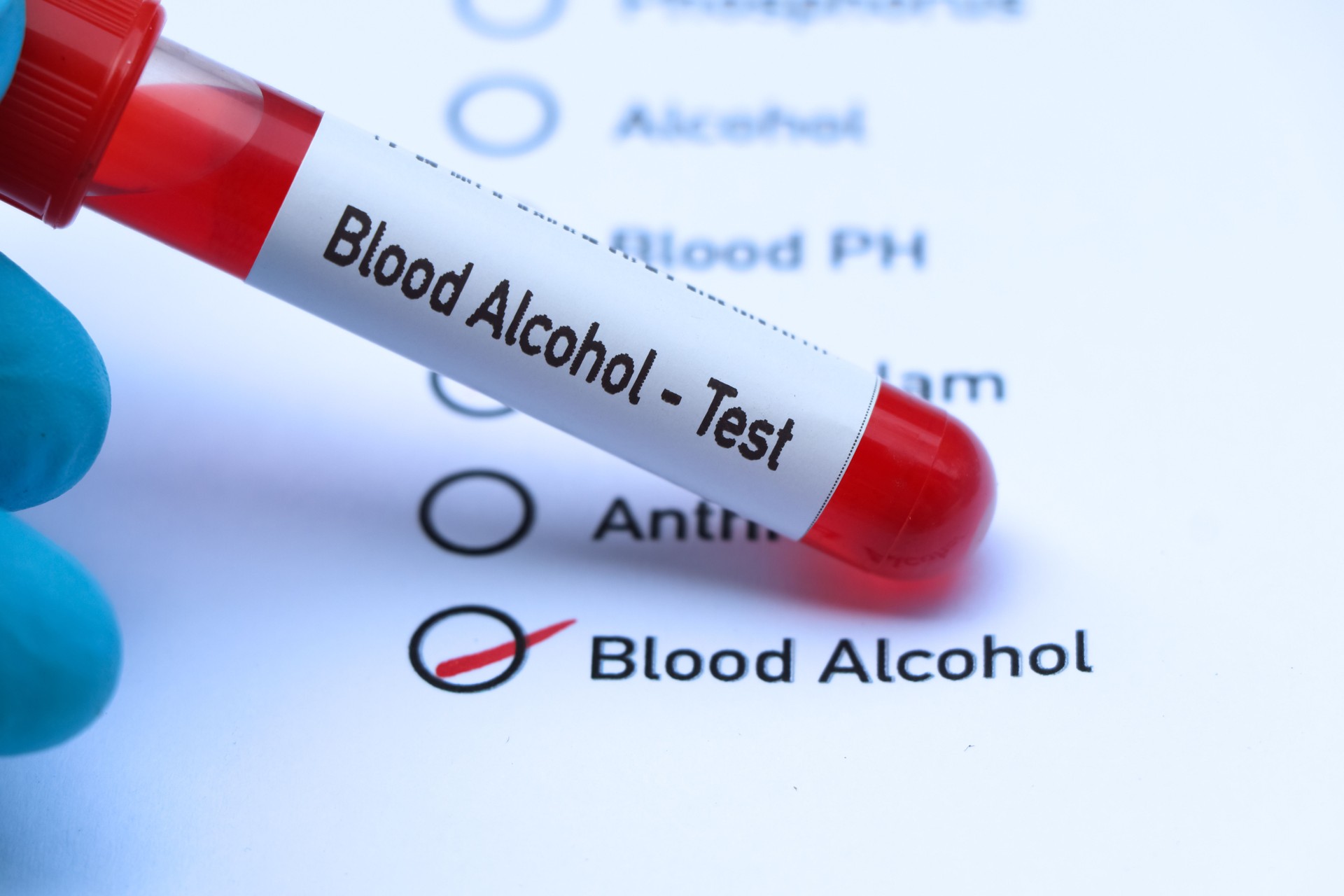 Blood Alcohol test to look for abnormalities from blood