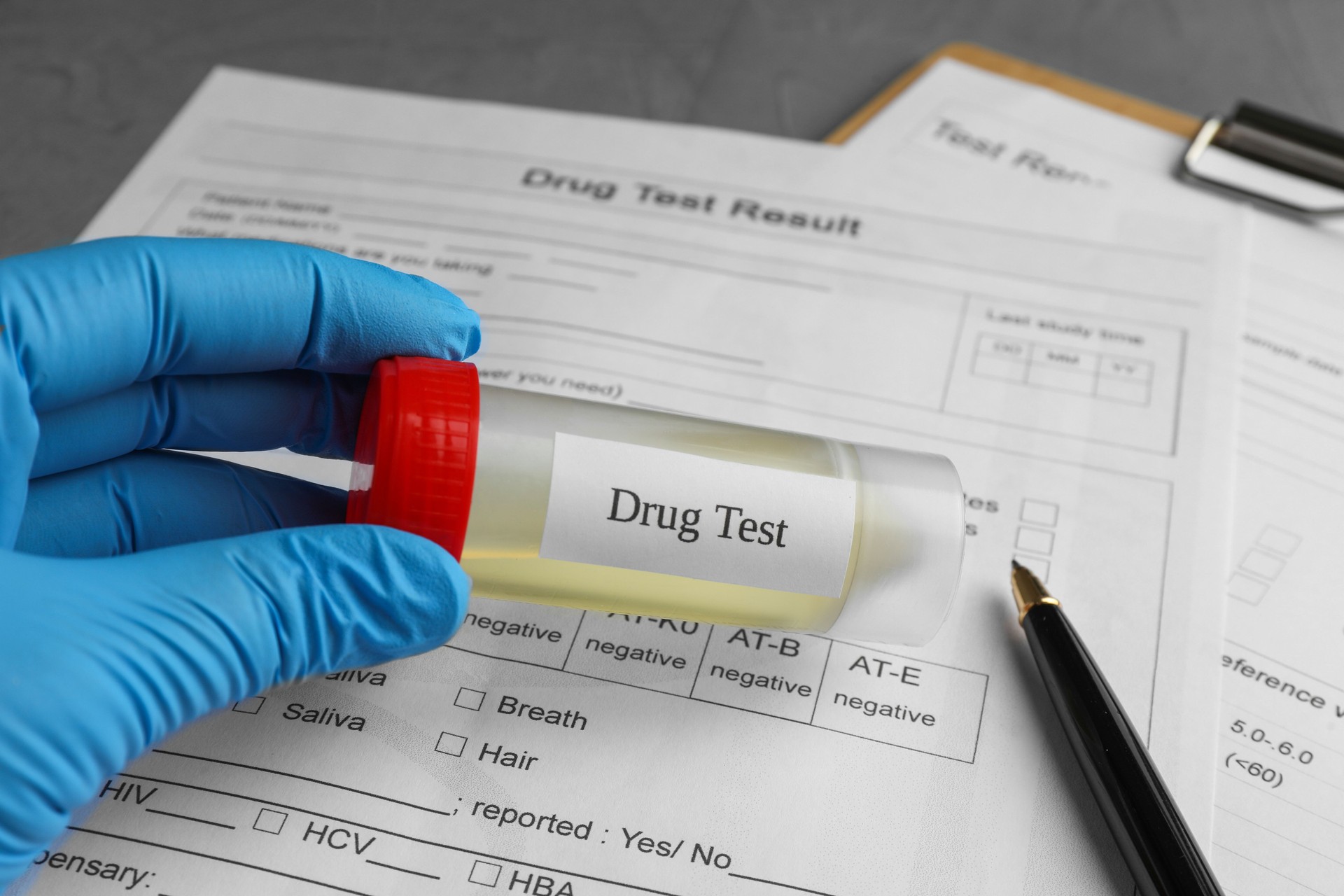 Drug test. Laboratory worker holding container with urine sample over medical forms on table, closeup